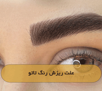 علت ریزش رنگ تاتو