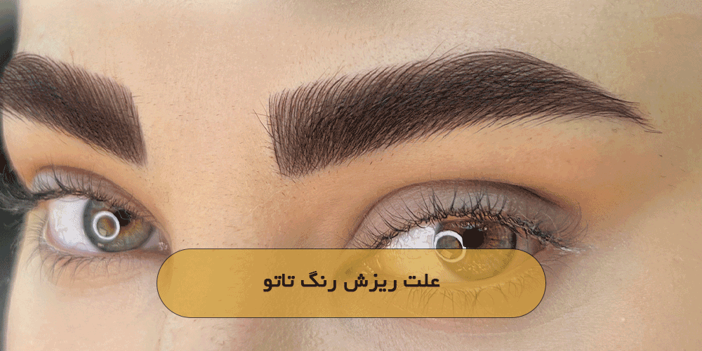 علت ریزش رنگ تاتو