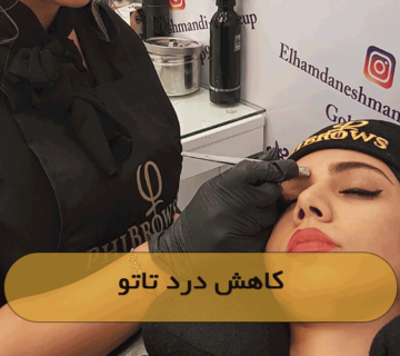 کاهش درد تاتو