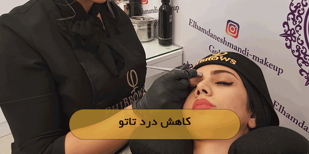 کاهش درد تاتو