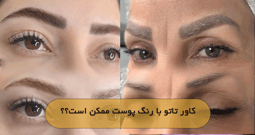 کاور تاتو با رنگ پوست ممکن است؟؟