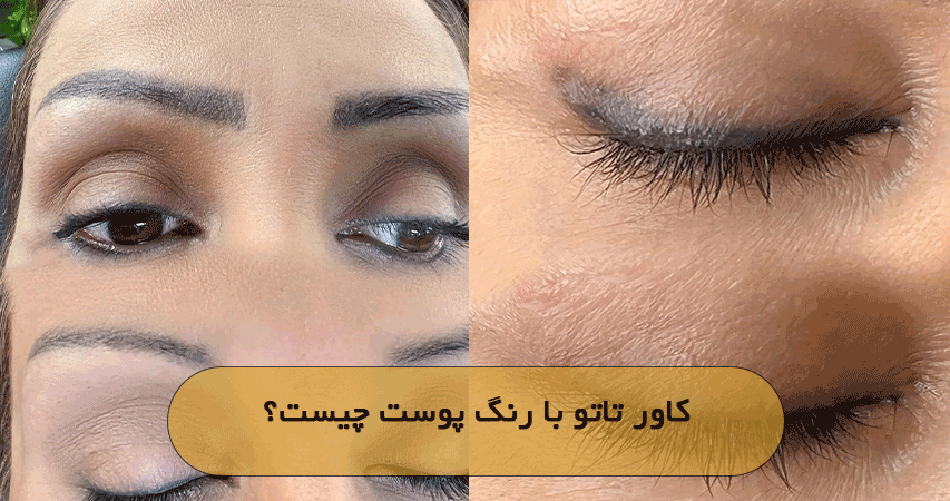 کاور تاتو با رنگ پوست چیست؟