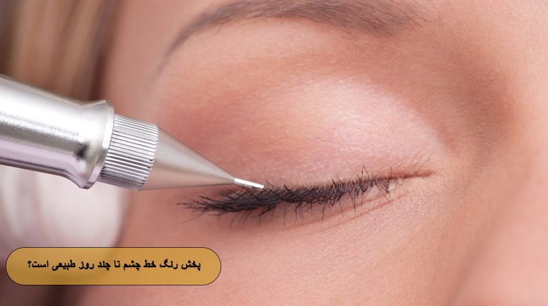 پخش رنگ خط چشم تا چند روز طبیعی است؟