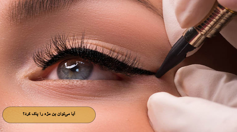 آیا می‌توان بن مژه را پاک کرد؟