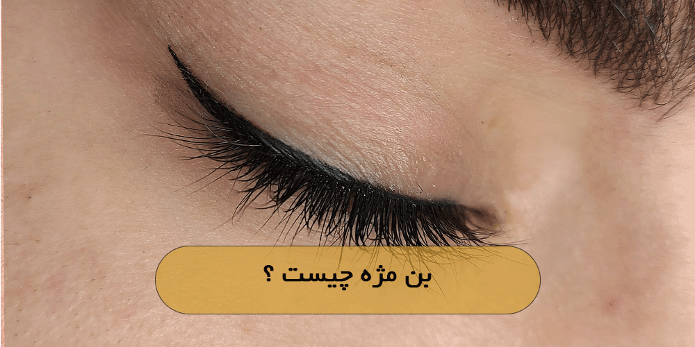 بن مژه چیست ؟