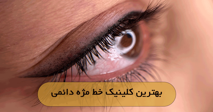 بهترین کلینیک خط مژه دائمی
