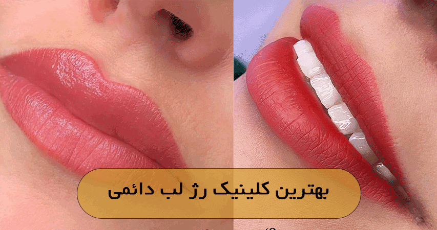 بهترین کلینیک رژ لب دائمی