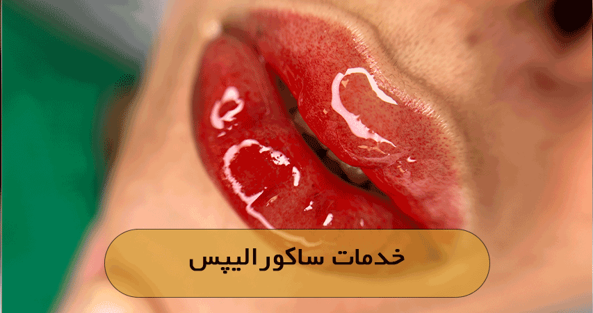 خدمات ساکورالیپس