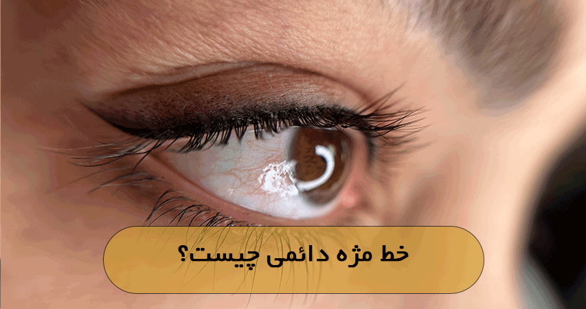 خط مژه دائمی چیست؟