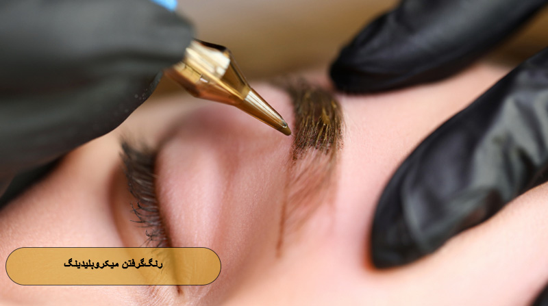 رنگ گرفتن میکروبلیدینگ