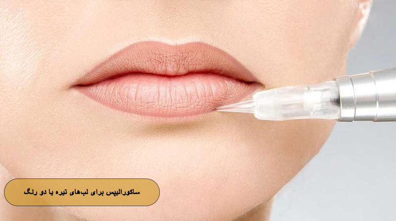 ساکورالیپس برای لب‌های تیره یا دو رنگ