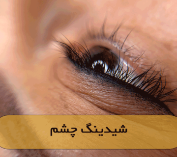 شیدینگ چشم