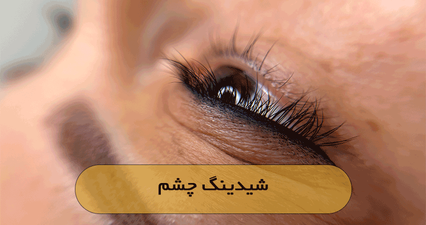 شیدینگ چشم