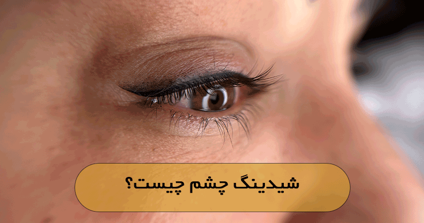 شیدینگ چشم چیست؟