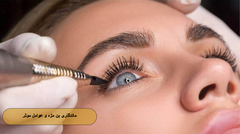 ماندگاری بن مژه و عوامل موثر