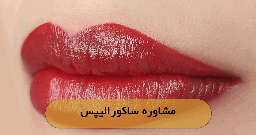 مشاوره ساکورالیپس