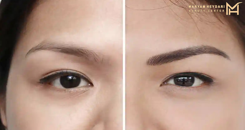 هاشور مویی ابرو چیست؟