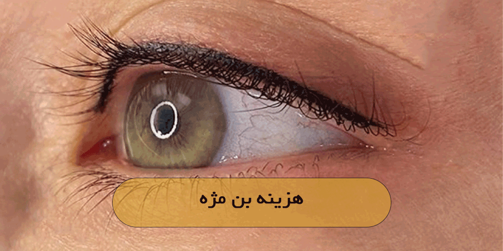 هزینه بن مژه