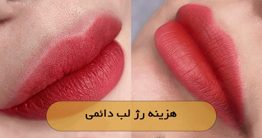 هزینه رژ لب دائمی