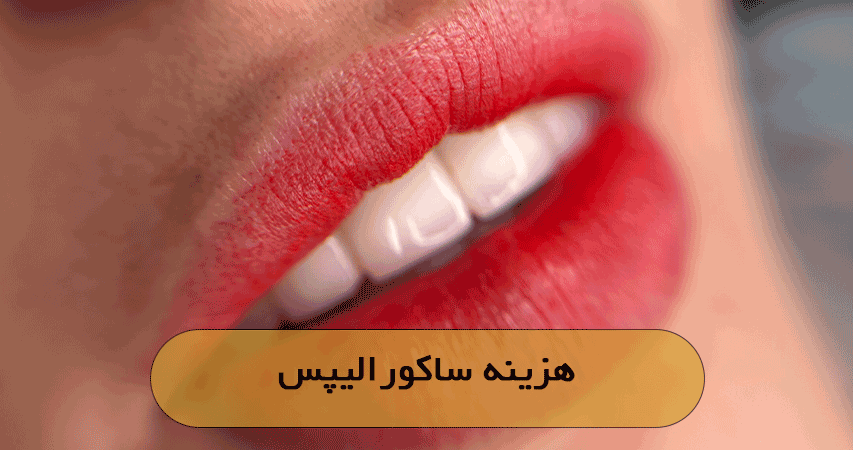 هزینه ساکورالیپس