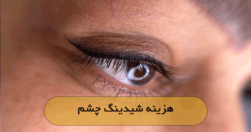 هزینه شیدینگ چشم