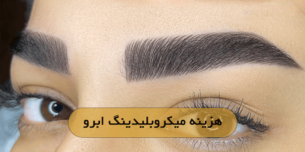 هزینه میکروبلیدینگ ابرو