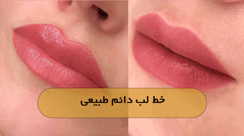 خط لب دائم طبیعی