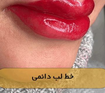 خط لب دائمی