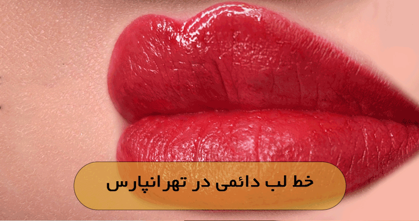 خط لب دائمی در تهرانپارس