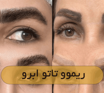 ریموو تاتو ابرو