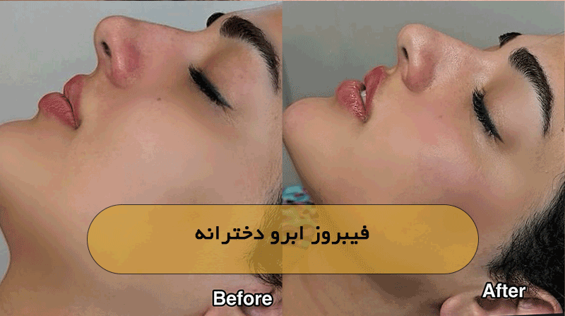فیبروز ابرو دخترانه