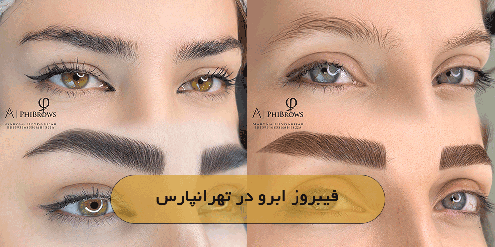 فیبروز ابرو در تهرانپارس