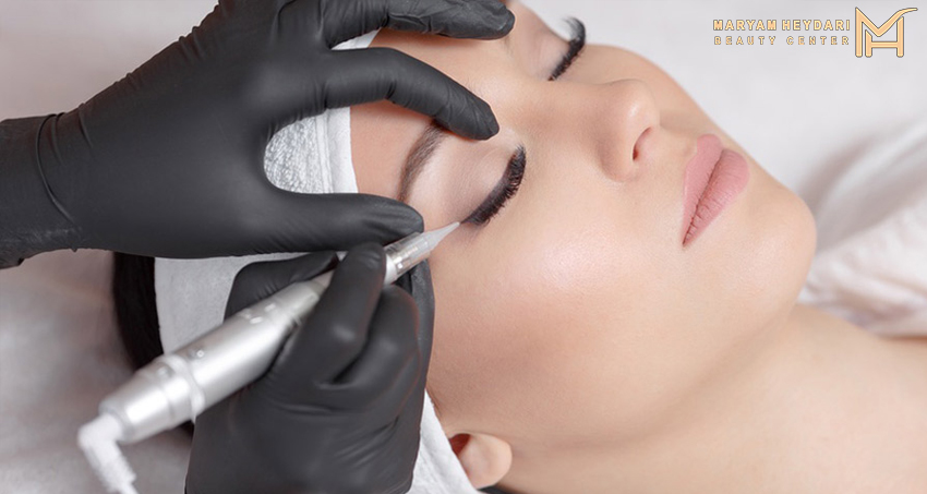 مراحل انجام خط چشم دائمی چگونه است؟