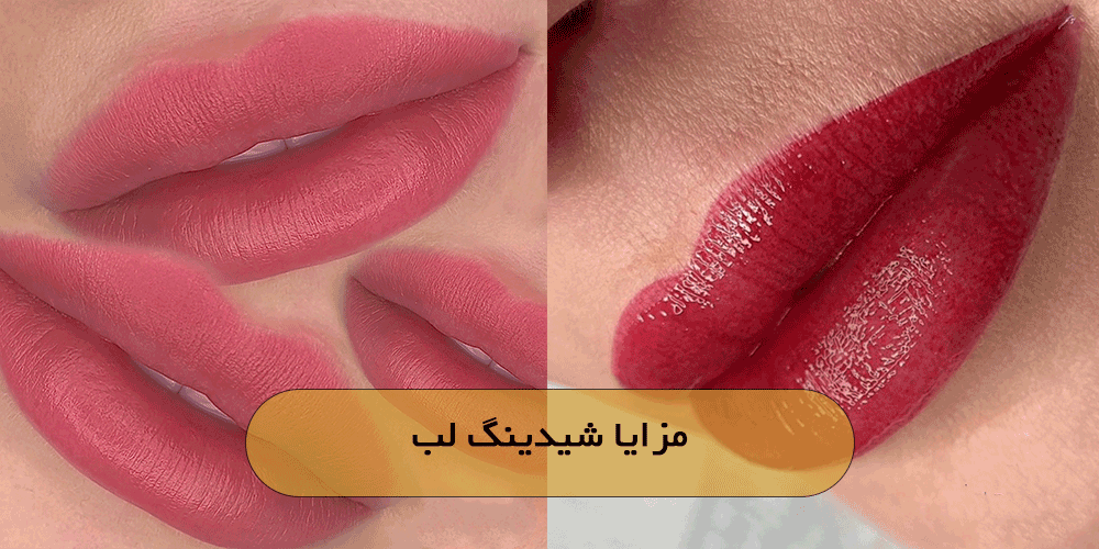 مزایا شیدینگ لب