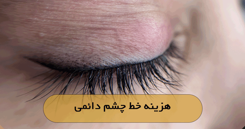 هزینه خط چشم دائمی