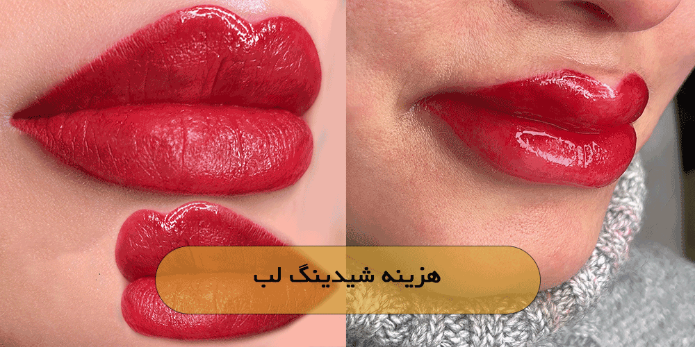 هزینه شیدینگ لب