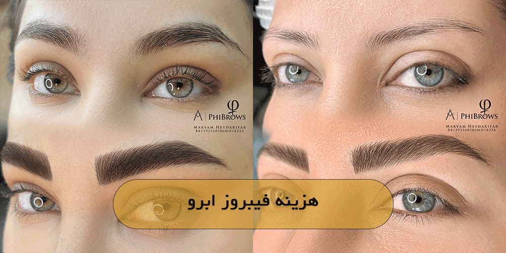 هزینه فیبروز ابرو