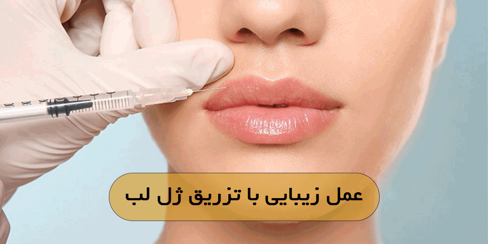 عمل زیبایی با تزریق ژل لب