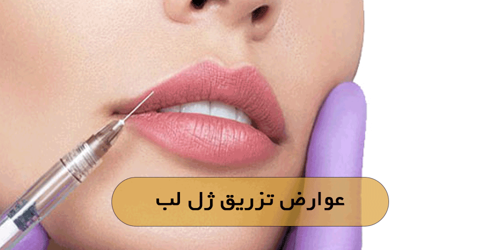 عوارض تزریق ژل لب