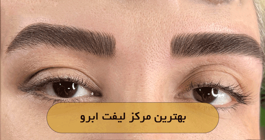بهترین مرکز لیفت ابرو