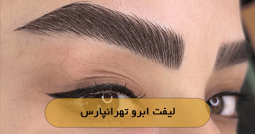 لیفت ابرو تهرانپارس