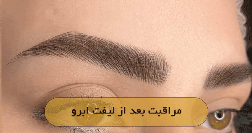 مراقبت بعد از لیفت ابرو