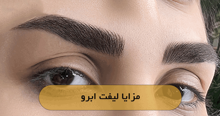 مزایا لیفت ابرو