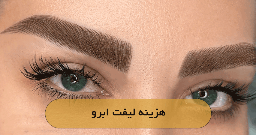 هزینه لیفت ابرو