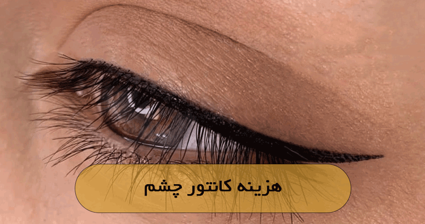 هزینه کانتور چشم