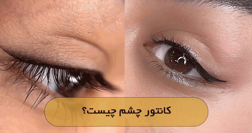 کانتور چشم چیست؟