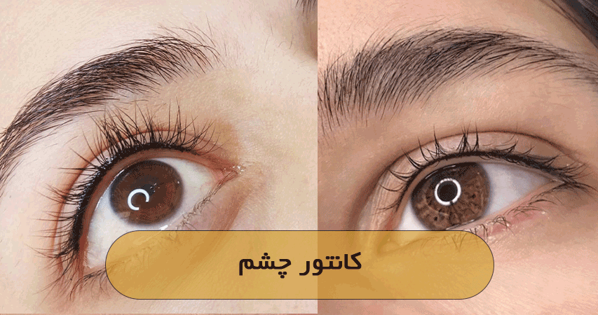 کانتور چشم