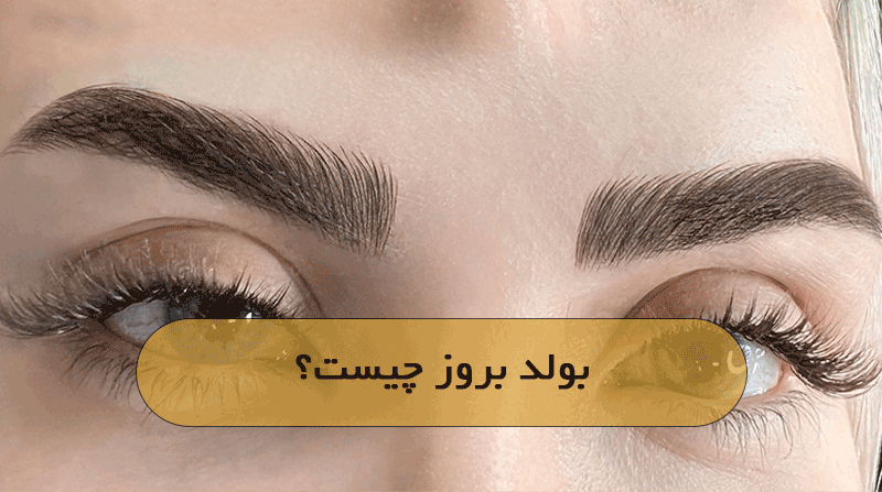 بولد بروز چیست؟