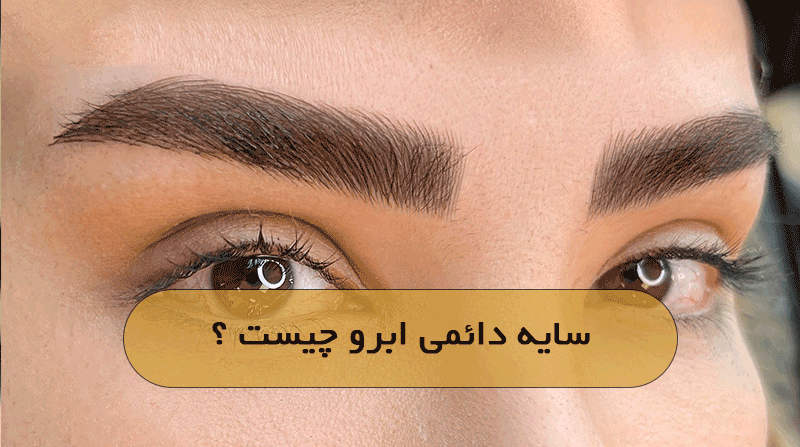 سایه دائمی ابرو چیست ؟
