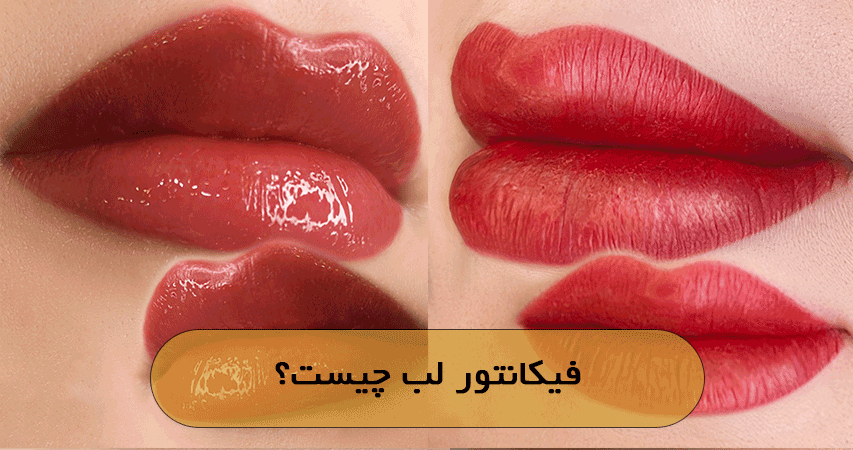 فیکانتور لب چیست؟